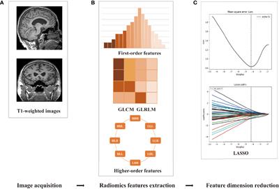 Diagnosis of Subcortical Ischemic Vascular Cognitive Impairment With No Dementia Using Radiomics of Cerebral Cortex and Subcortical Nuclei in High-Resolution T1-Weighted MR Imaging